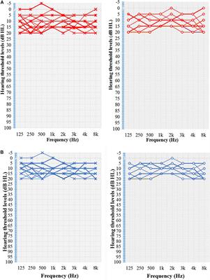 Abnormal Spontaneous Neural Activity of the Central Auditory System Changes the Functional Connectivity in the Tinnitus Brain: A Resting-State Functional MRI Study
